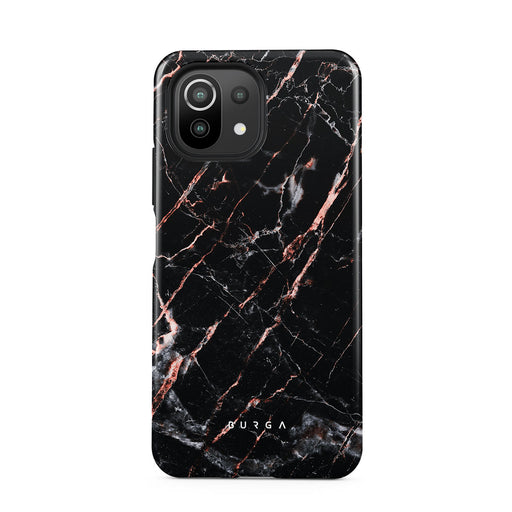 MB_30_XiaomiMI11Lite_TH